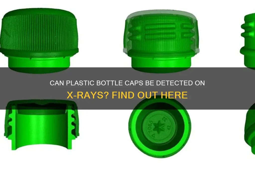 will plastic bottle cap show up on x ray