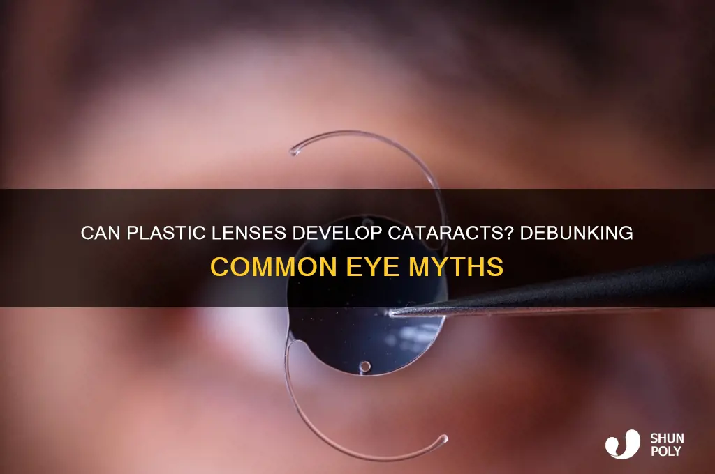will plastic lens get cataracts