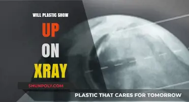 Unveiling the Truth: Will Plastic Appear on an X-ray?