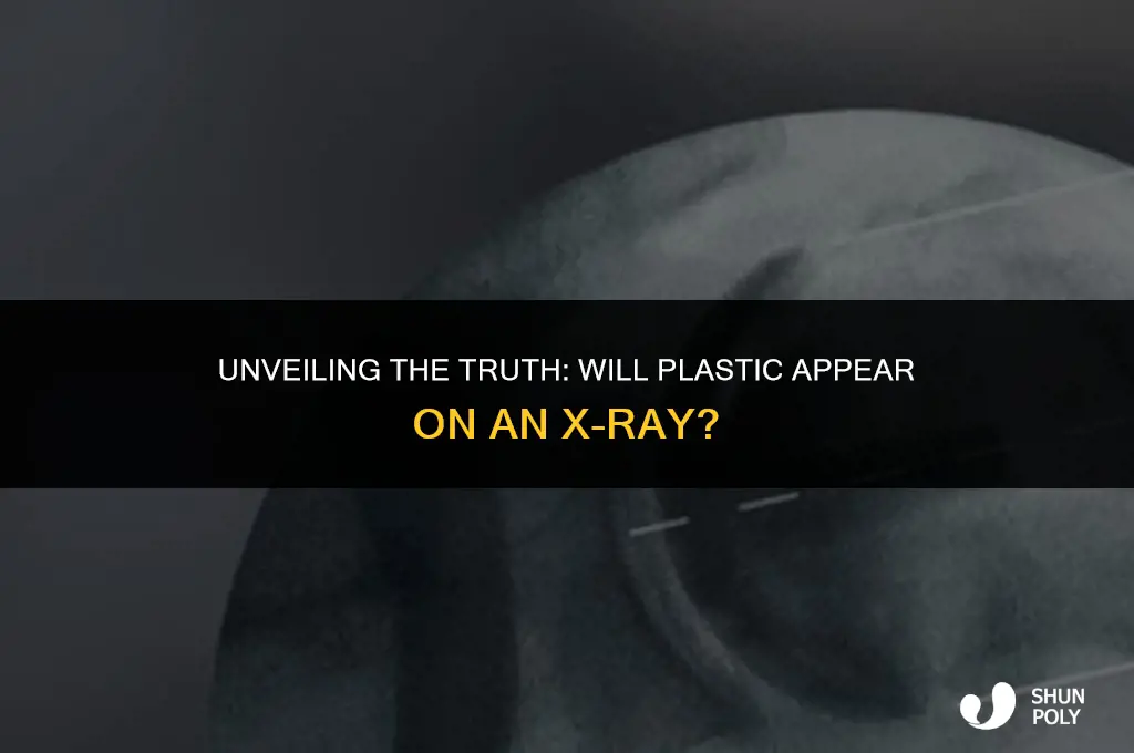 will plastic show up on xray