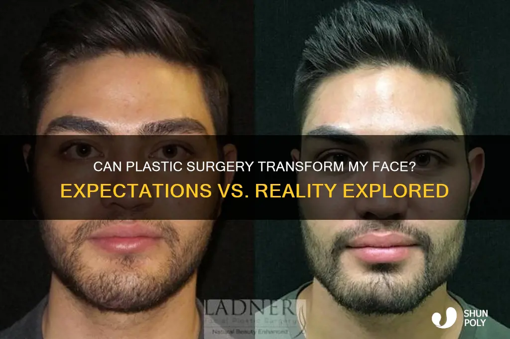 will plastic surgery fix my face