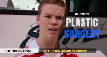 Will Poulter Plastic Surgery: Fact-Checking Transformation Rumors and Truths