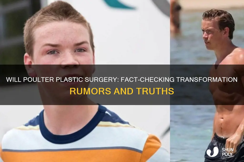 will poulter plastic surgery