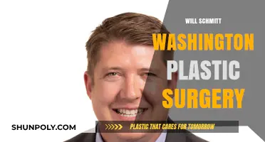 Will Schmitt Washington's Plastic Surgery Transformation: Fact or Fiction?