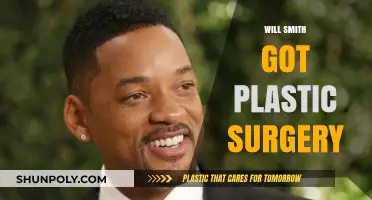 Will Smith's Transformation: Unveiling the Truth About His Plastic Surgery