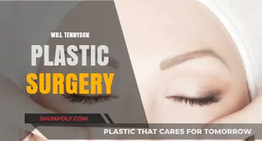 Will Tennyson Plastic Surgery: Fact-Checking Rumors and Speculations