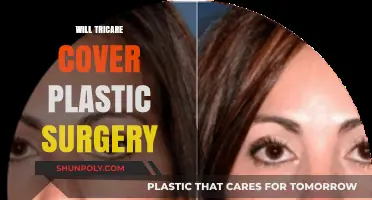 Does Tricare Cover Plastic Surgery? Understanding Your Benefits and Limitations