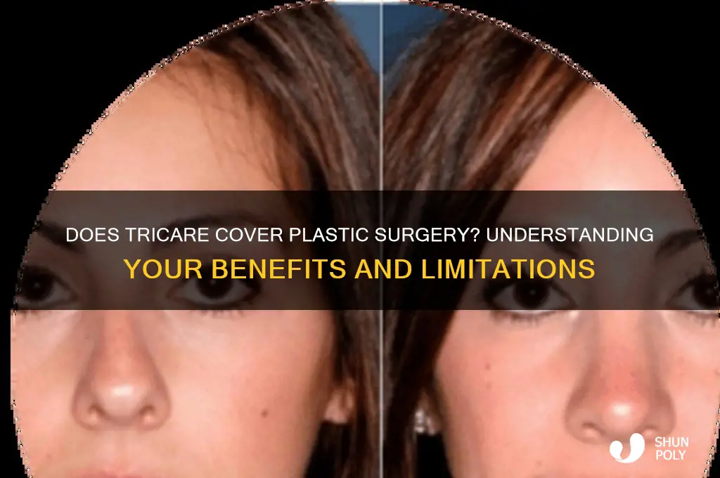 will tricare cover plastic surgery