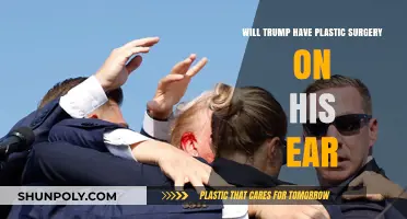 Will Trump Undergo Plastic Surgery for His Ear? Speculations Rise