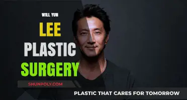 Will Yun Lee Plastic Surgery: Fact-Checking Rumors and Speculations