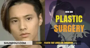 Unveiling Won Bin's Transformation: Plastic Surgery Speculations and Truths