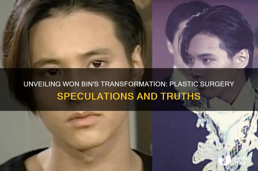 won bin plastic surgery