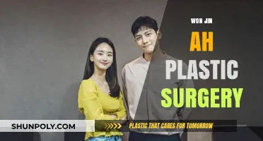 Won Jin Ah Plastic Surgery: Unveiling the Truth Behind Her Transformation