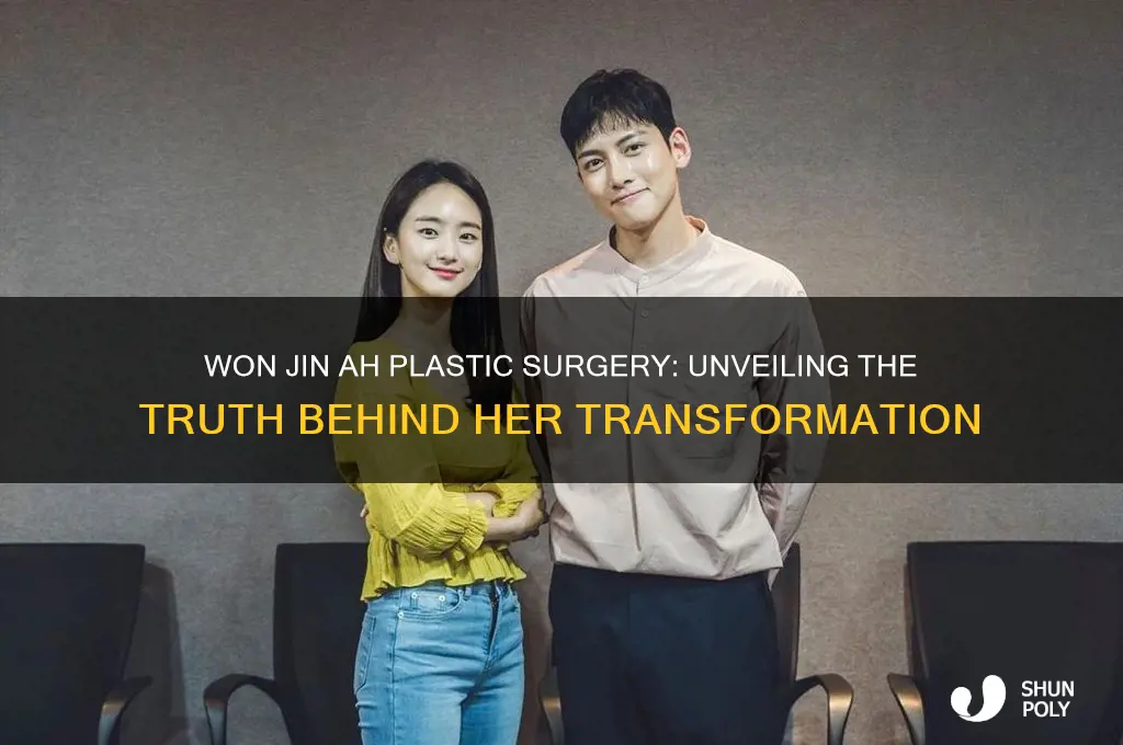won jin ah plastic surgery