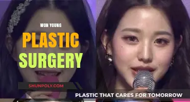 Exploring Won Young's Plastic Surgery Transformation: Truths and Speculations