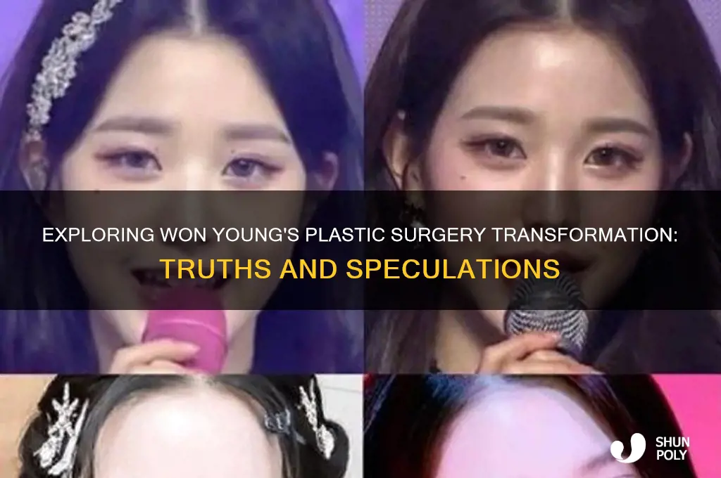 won young plastic surgery