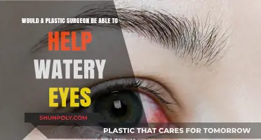 Can Plastic Surgery Fix Watery Eyes? Expert Insights and Solutions