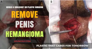 Penis Hemangioma Removal: Urologist or Plastic Surgeon Expertise?