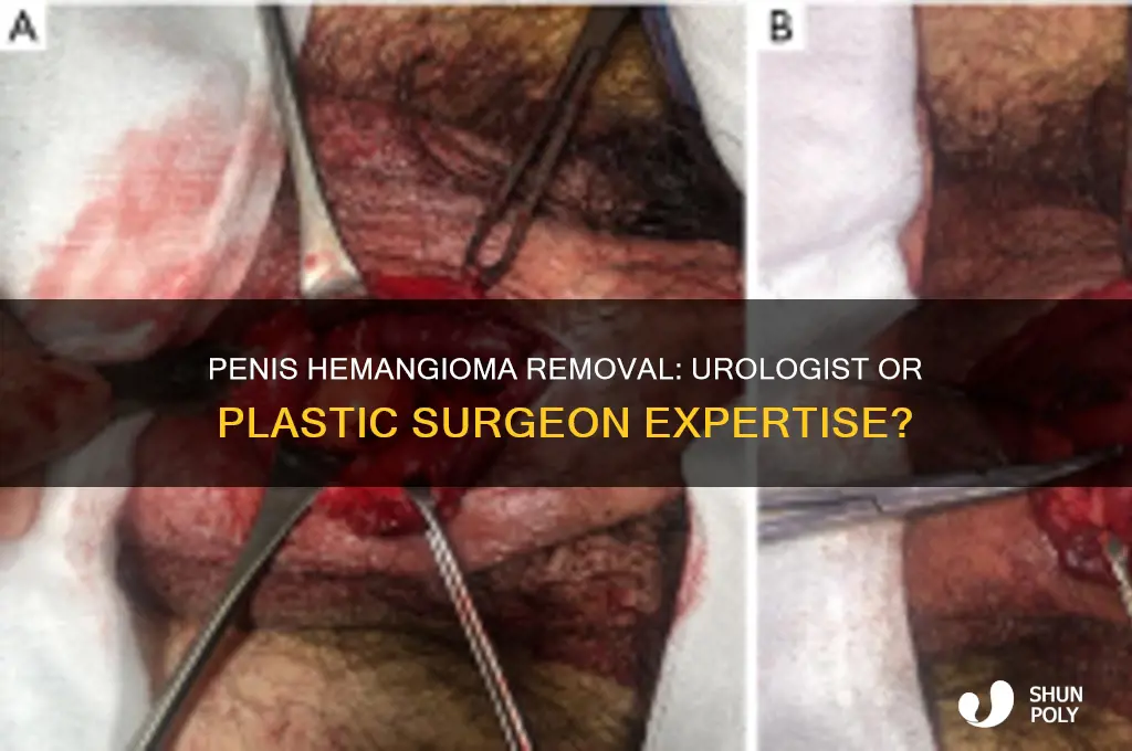 would a urologist or plastic surgeon remove penis hemangioma