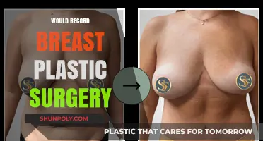 Considering Breast Plastic Surgery? What to Know Before Recording Your Journey