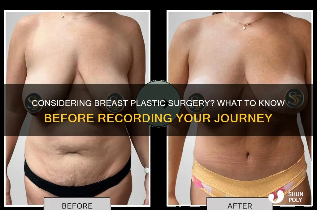 would record breast plastic surgery