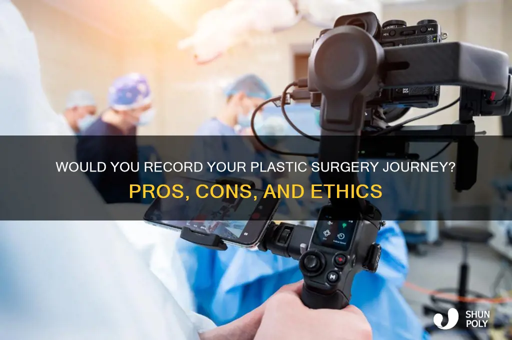 would record plastic surgery