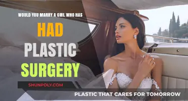 Plastic Surgery and Love: Would You Marry a Woman Who’s Had Work Done?